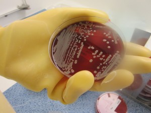 mrsa